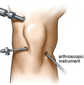 1698141684902720.png ArthroKnee-294x300.png