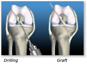 1698141698961410.png Screen-Shot-2017-08-21-at-6.27.55-pm-300x219.png