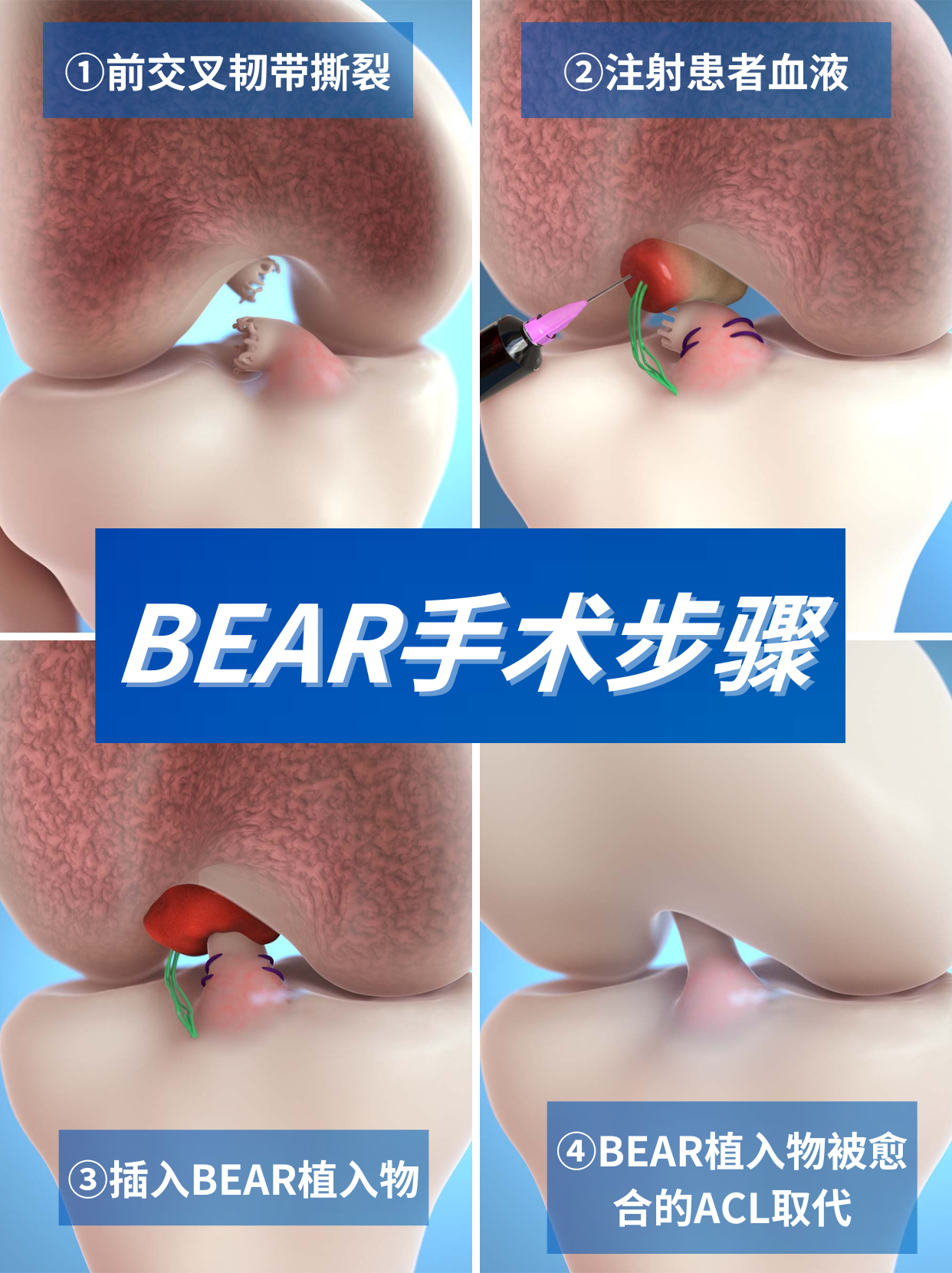 1698142029590026.png 1698142029590026.png