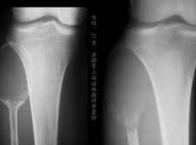 1718278081375498.png image.png