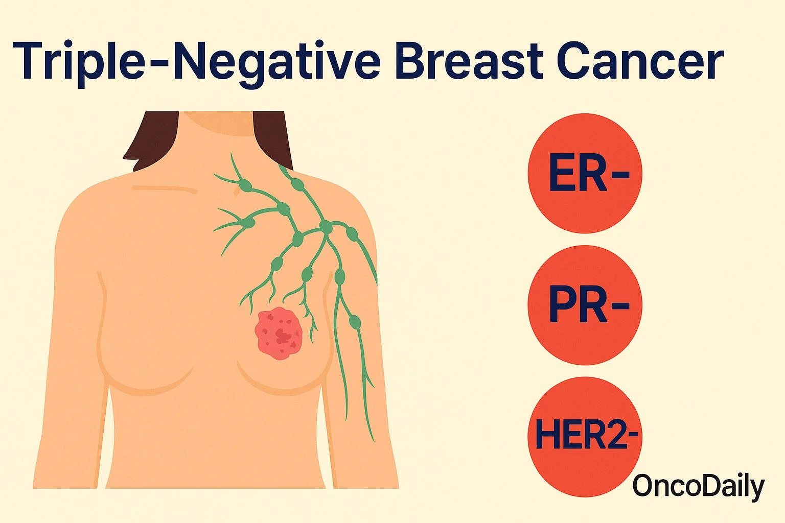 Triple-Negative Breast Cancer