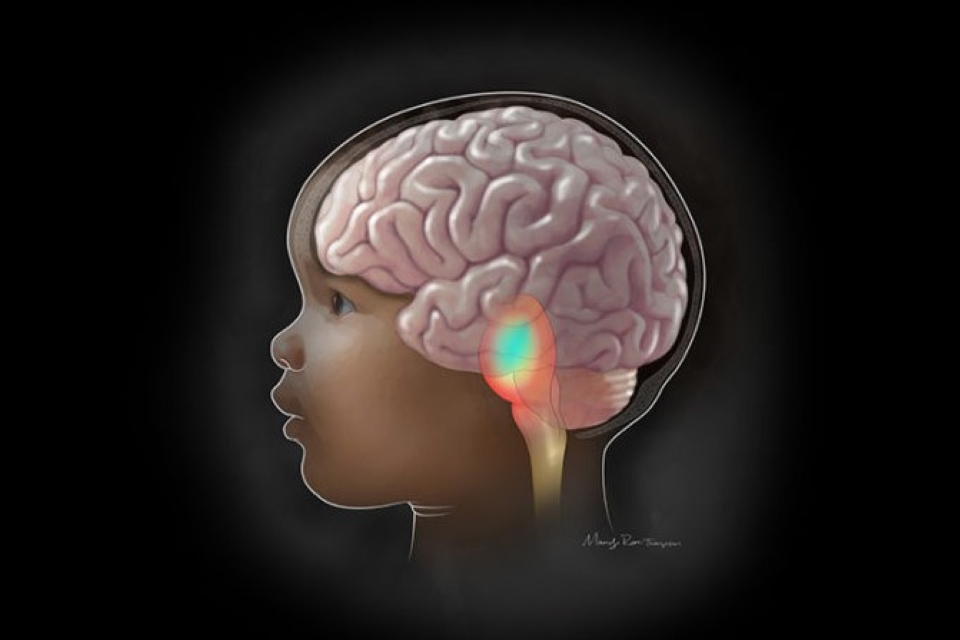 1776132220170493.jpg dipg_final-color-v4-flat-rgb_crop.jpg