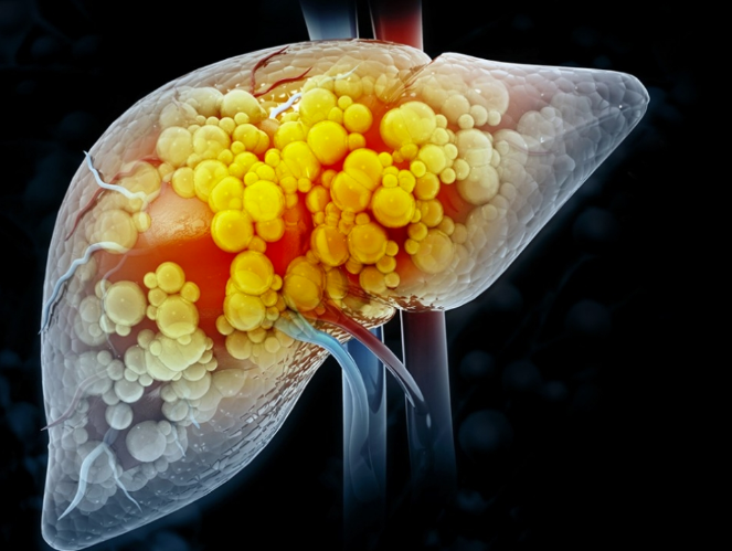 美国MD安德森癌症中心：肝细胞癌的治疗最新进展