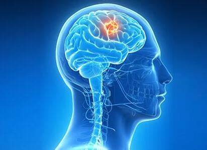 去美国治疗脑胶质瘤