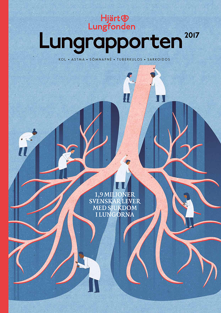 出国看病  美国看病新药：Pembrolizumab提高非小细胞肺癌（NSCLC）患者生存率