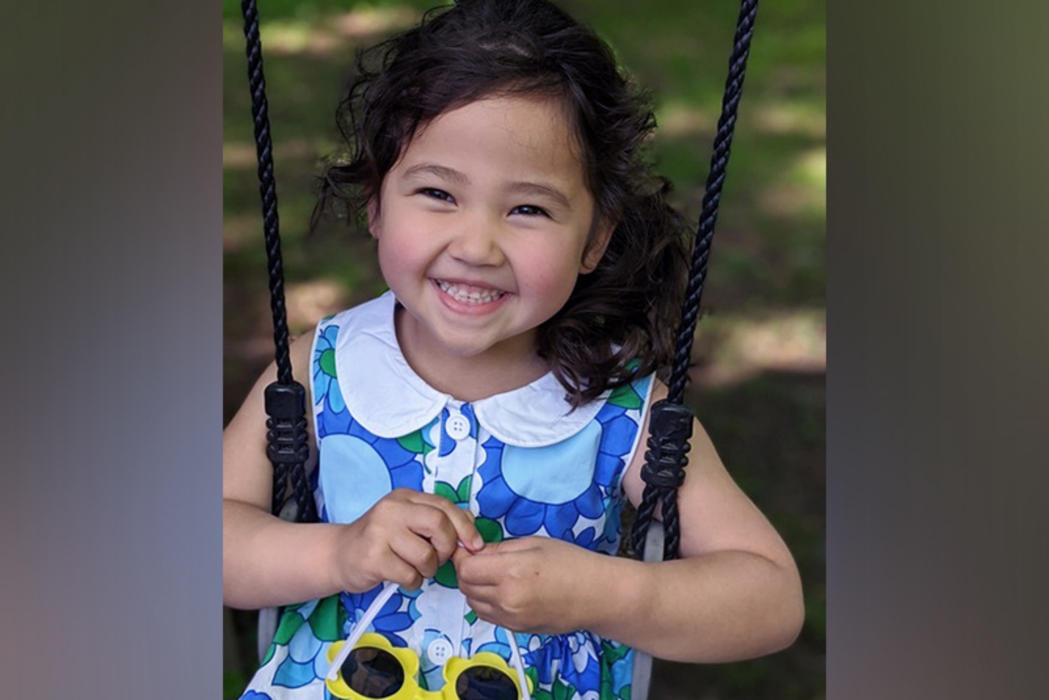 美国治疗海绵状畸形(Cavernous Malformation) 最好医院和治疗案例