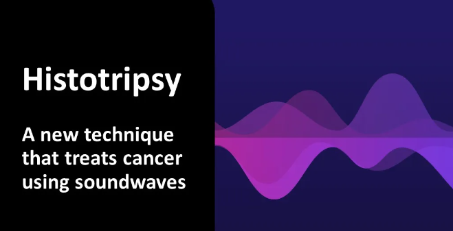 李嘉诚引进的超声肝癌治疗仪Histotripsy, 2024国内患者申请指南