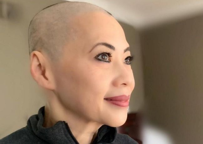 美国安德森医院，子宫内膜癌治疗的5种创新方法和费用