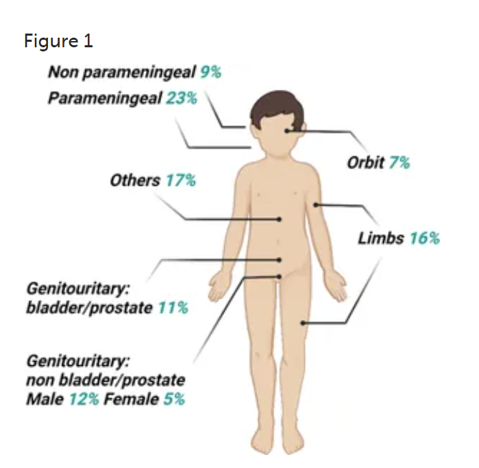 去美国看横纹肌肉瘤流程复杂？美联医邦帮您简化预约，缩短等待时间！