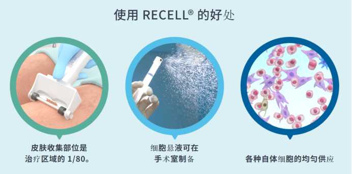 美国治疗皮肤缺陷新疗法：干细胞再生技术加速皮肤愈合