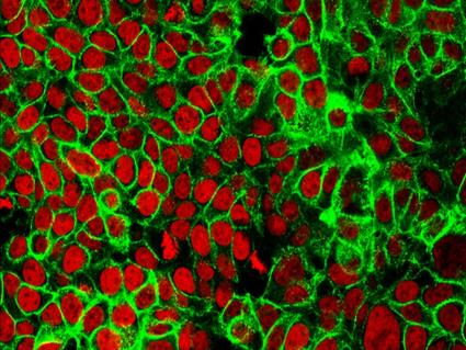 早发性结直肠癌的潜在警告信号和筛查措施