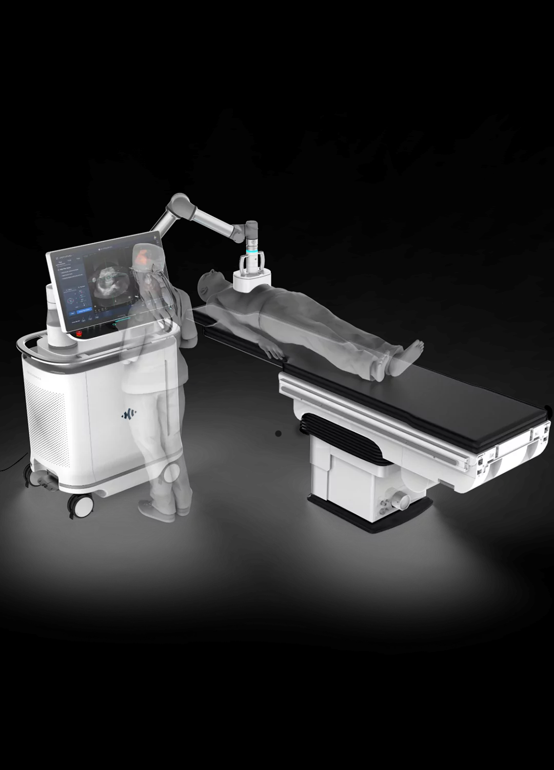 美国实施肝癌碎化术Histotripsy医院排名